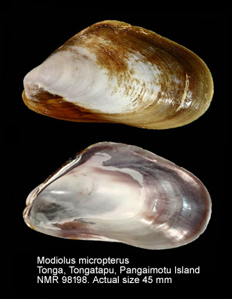 Modiolus / Muscular Anatomy Of The Corner Of The Mouth And Its Surgical